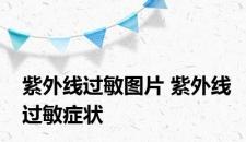 紫外线过敏图片 紫外线过敏症状
