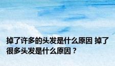 掉了许多的头发是什么原因 掉了很多头发是什么原因？