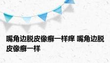嘴角边脱皮像癣一样痒 嘴角边脱皮像癣一样