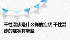 干性湿疹是什么样的症状 干性湿疹的症状有哪些